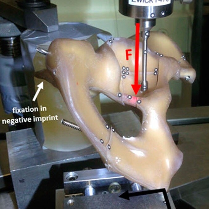 Publ Comparison of Fixation Techniques