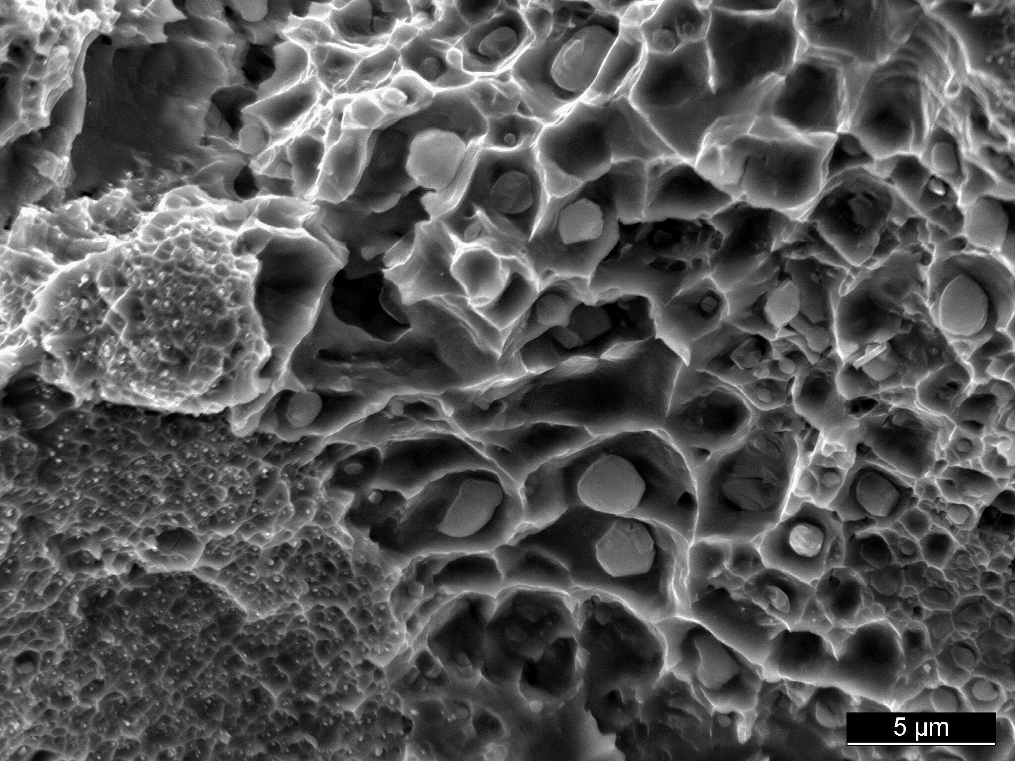 IL-6: Rasterelektronenmikroskop (REM) und Mikrobereichsanalyse (EDX)